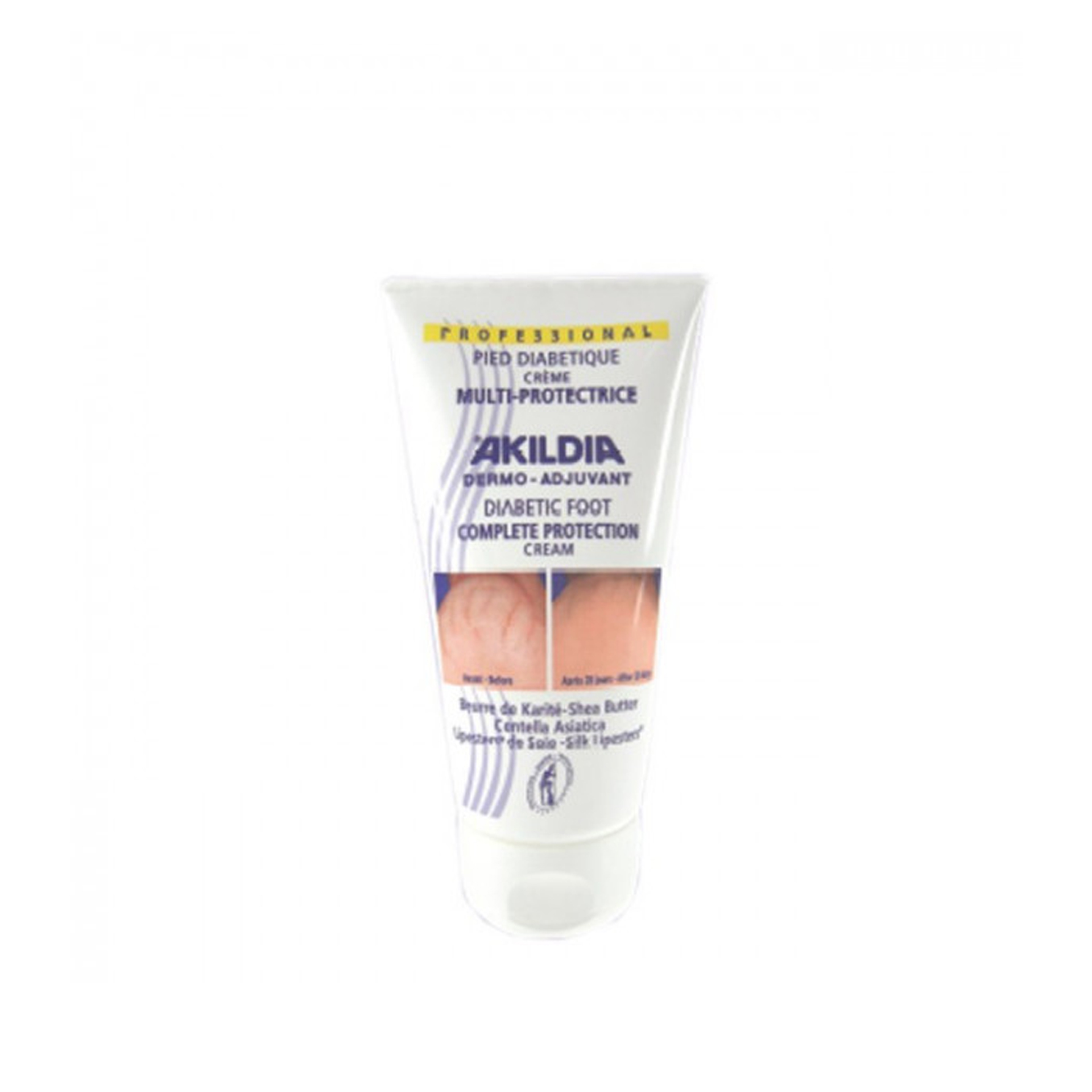 Akildia Creme Pé Diabético 150ml